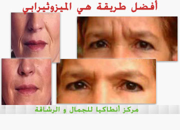 إزالة التجاعيد و التشققات